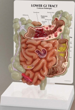 Lower GI Tract Pharmaceutical and Anatomical Model Gifts